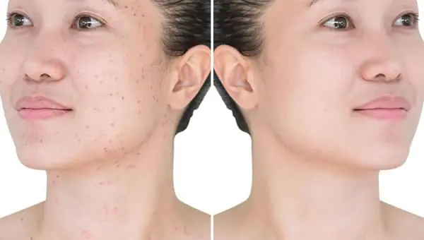 有皮膚炎及濕疹?