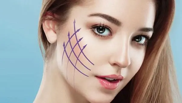 藍鑽魚骨線拉提